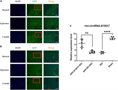 Inhibition by rno-circRNA-013017 of the apoptosis of motor neurons in anterior horn and descending axonal degeneration in rats after traumatic spinal cord injury